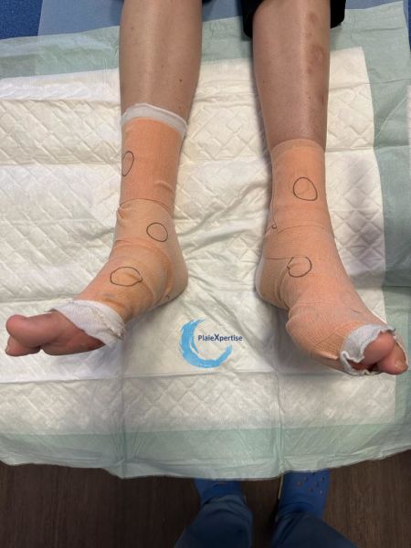 Fichier:Compression EI27.jpg