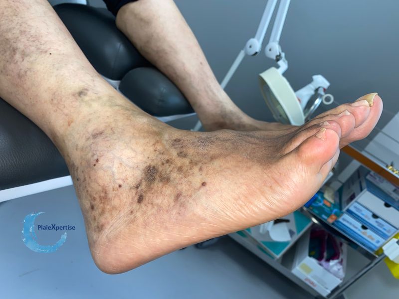 Fichier:Dermiteocre77.jpg