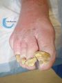 Ongles59.jpg