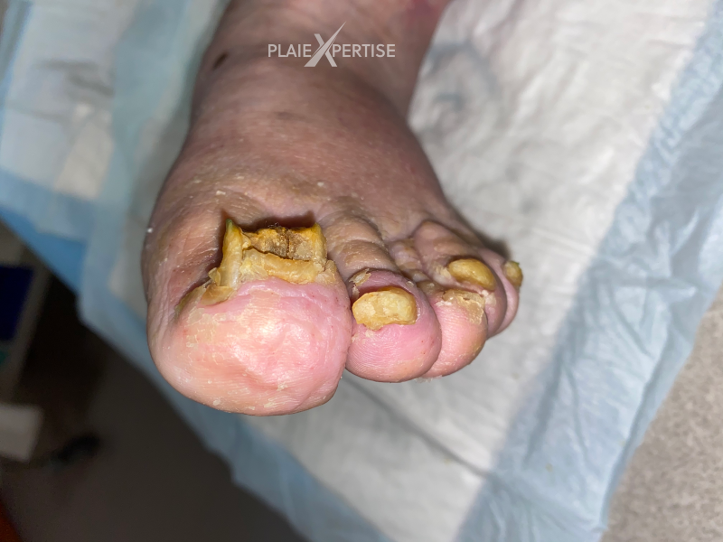 Fichier:Ongles48.png