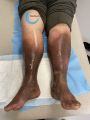 Dermiteocre66.jpg