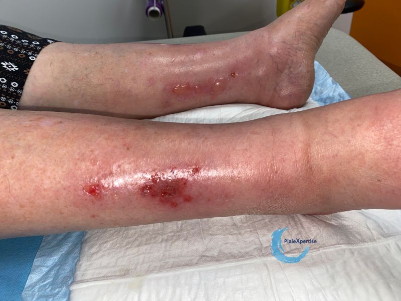 Fichier:Erosions post bulleuses10.jpg