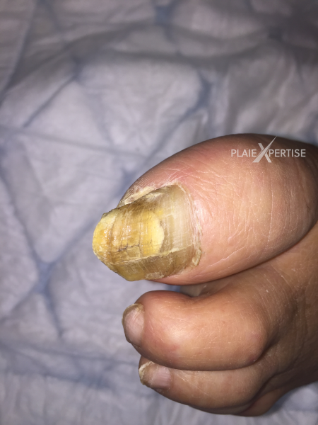 Fichier:Ongles17.png
