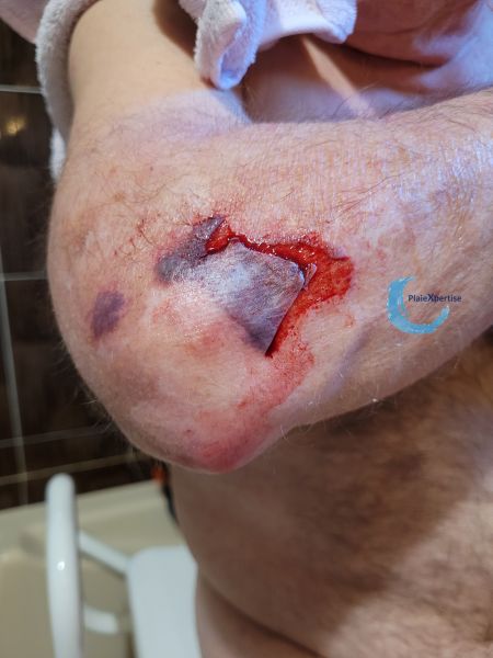Fichier:DCT74.jpg