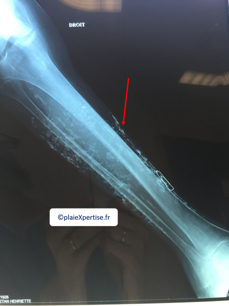 Fichier:Calci17.png
