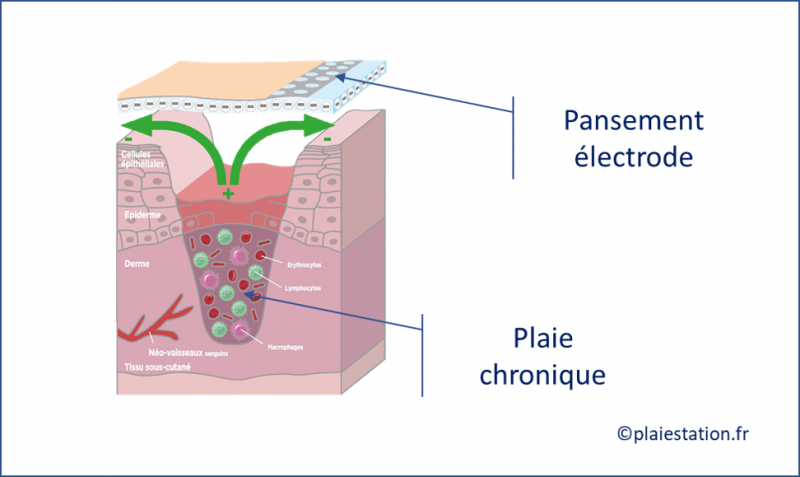 Fichier:Elec5.png