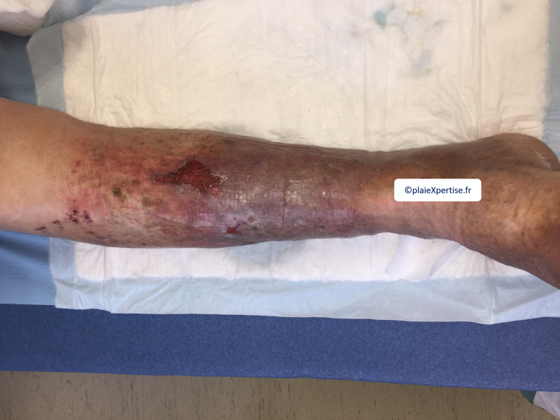 Fichier:Dermiteocre12.png