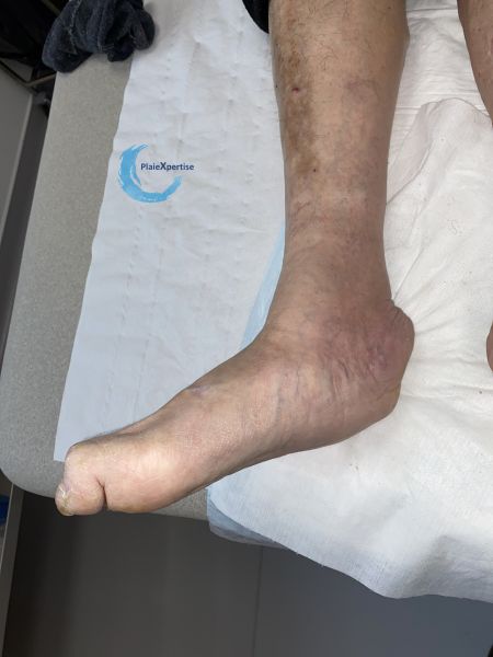 Fichier:Charcot3.jpg