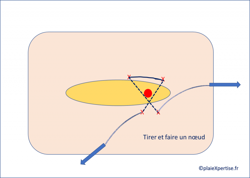 Fichier:X7.png