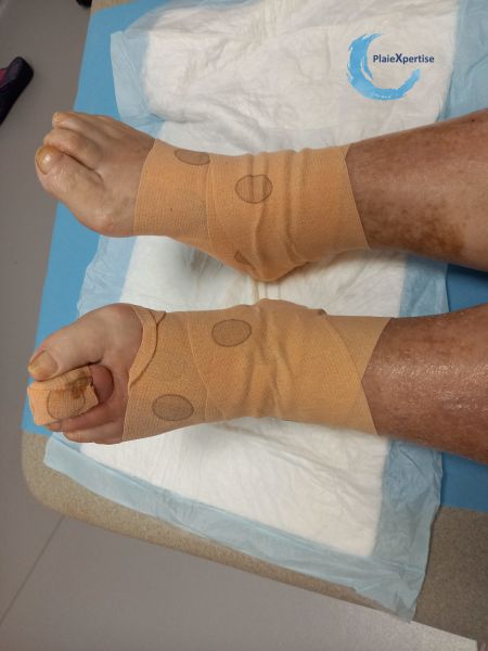 Fichier:Compression EI16.jpg