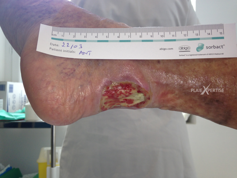 Fichier:Tendon-Reliquat6.png