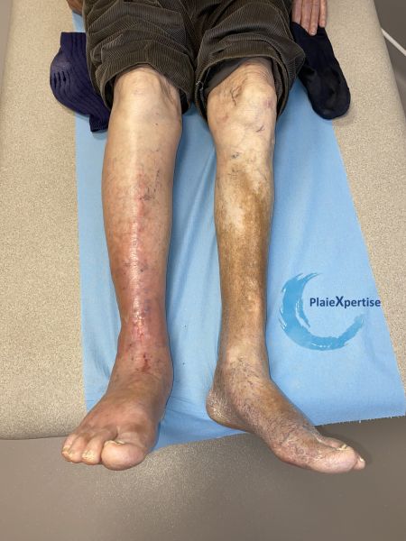 Fichier:Dermiteocre74.jpg