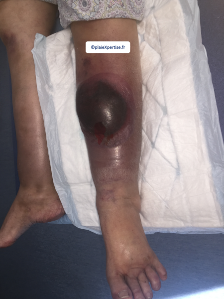Fichier:HD-Cas clinique 11.png