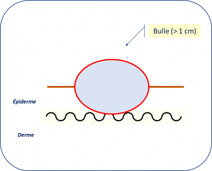Fichier:Bulle.png