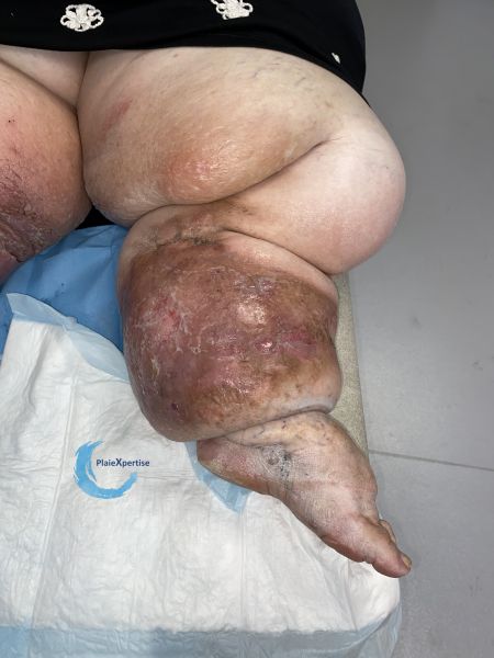 Fichier:Lipoed15.jpg