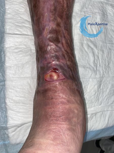 Fichier:Cou de pied69.jpg