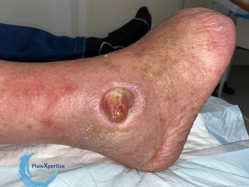 Fichier:Plan de glissement24.jpg