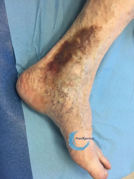 Fichier:Dermiteocre67.jpg