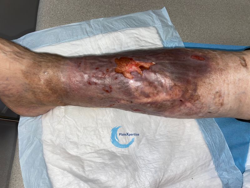 Fichier:Dermiteocre92.jpg