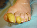 Ongles2.png