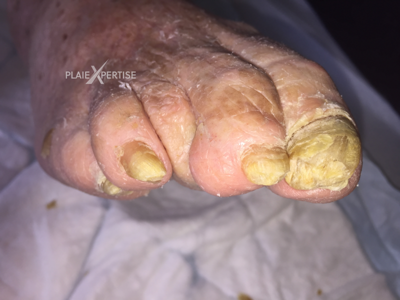 Fichier:Ongles13.png