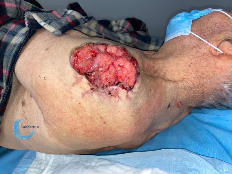 Fichier:Nodule3.jpg