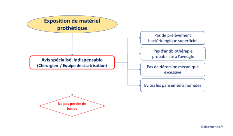 Fichier:Prothèse.png