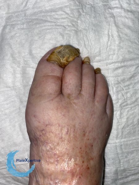 Fichier:Ongles68.jpg