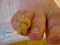 Ongles61.jpg