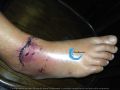 Cou de pied102.jpg