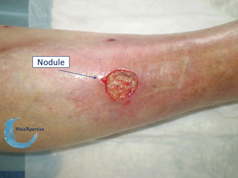 Fichier:Nodule2.jpg