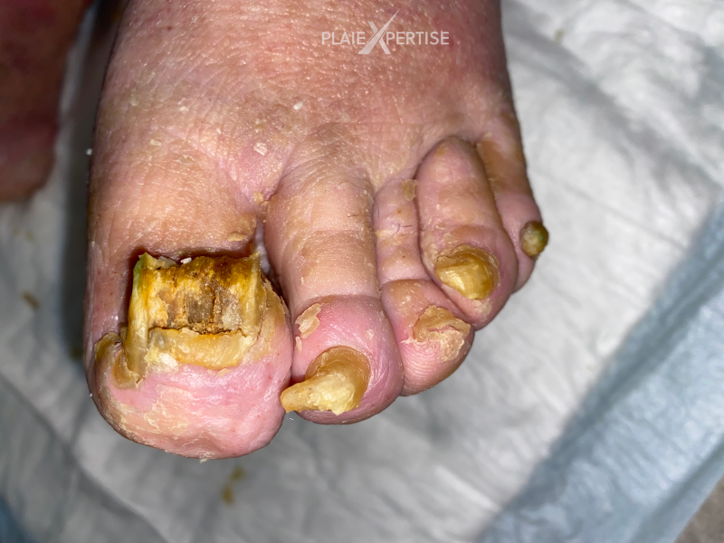 Fichier:Ongles35.png